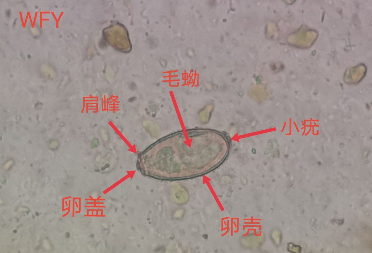 前后盘吸虫虫卵图片图片